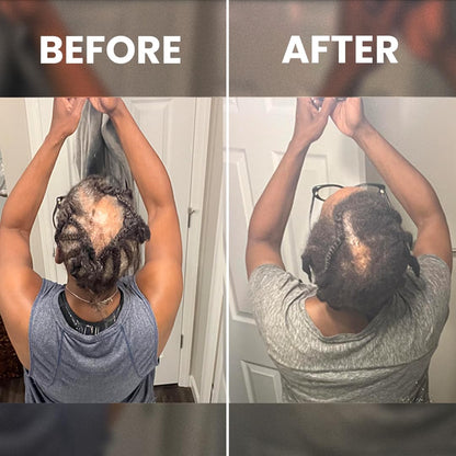 Cofulta Hair Growth Serum