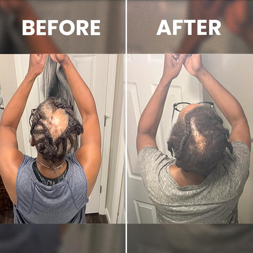 Cofulta Hair Growth Serum