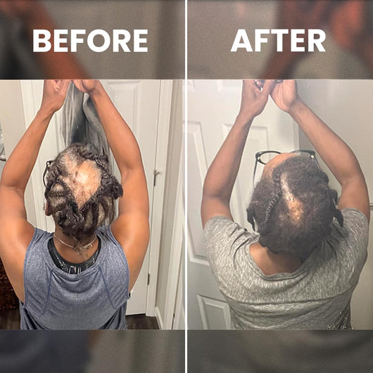 Cofulta Hair Growth Serum