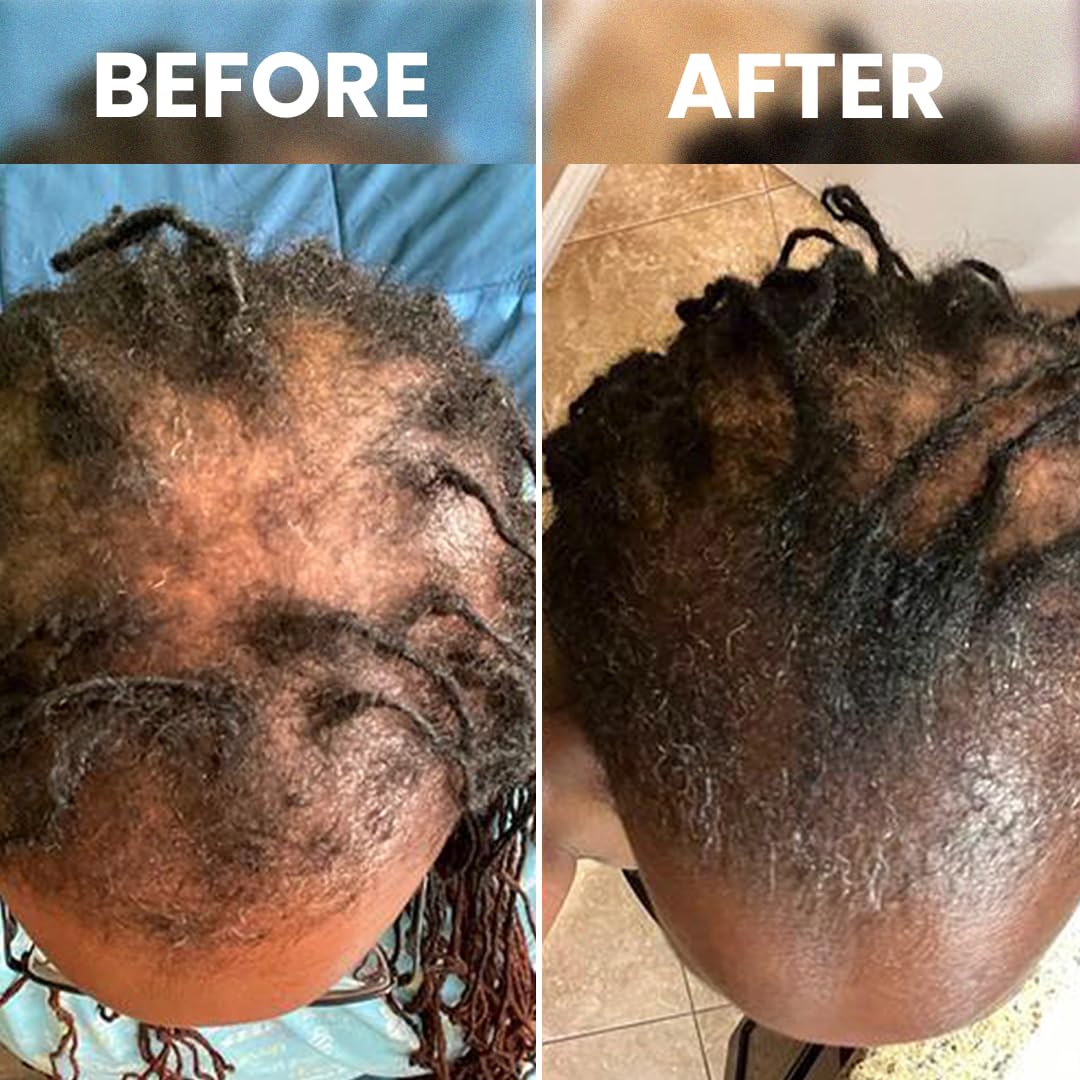 Cofulta Hair Growth Serum