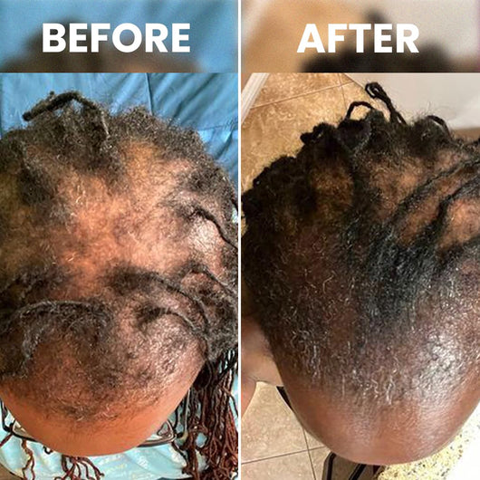 Cofulta Hair Growth Serum