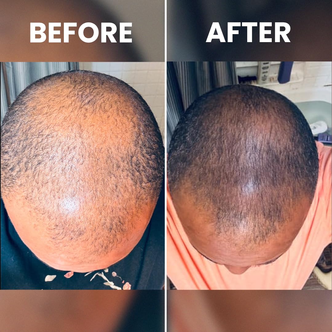 Cofulta Hair Growth Serum
